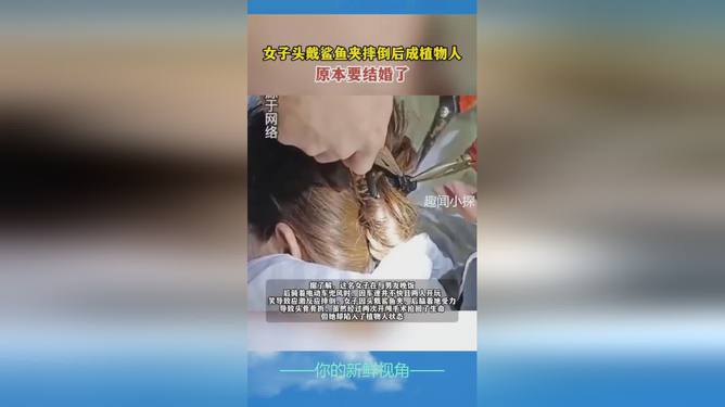 女子鲨鱼夹摔倒致植物人悲剧，警惕日常小物隐患