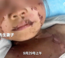 派出所回应6岁女童遭同学泼开水烫伤事件，强调科技助力保障儿童安全未来