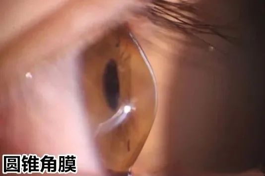 治疗步骤指南