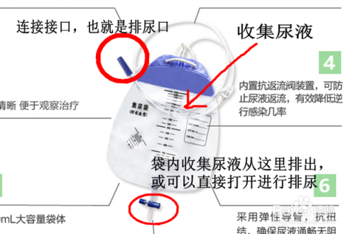 尿袋使用指南