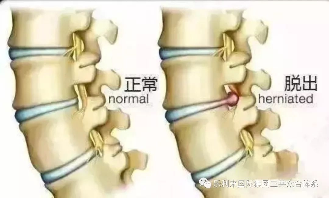 奇妙康复旅程